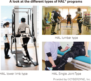 A look at the different types of HAL® programs